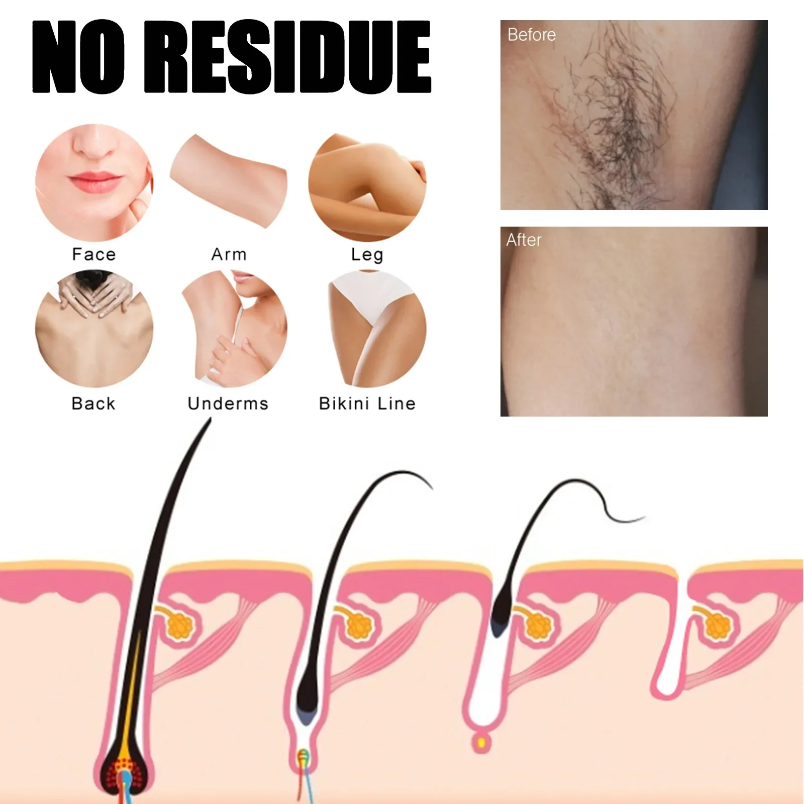 Hair Removal Spray Permanant Inhibitor Armpit Legs Arms Painless Beard Bikini Intimate Facial Hair Removal for Man Women 6