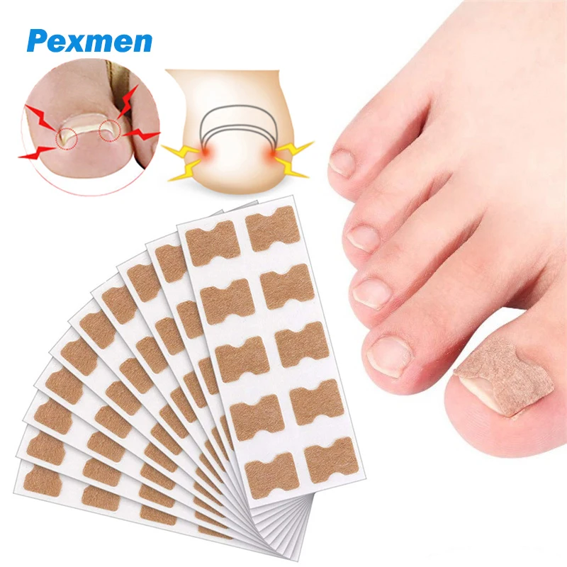 Pexmen 10/20/50/100/200Pcs Ingrown Toenail Correction Stickers Toenail Corrector Patch Big Toe Nail Corrector Patch