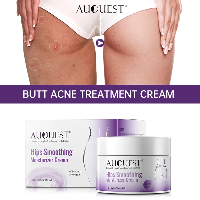 

AUQUEST Butt Body Acne Whitening Cream Acne Clearing Spot Treatment Lotion Skin Care for Buttock Thigh Whiten Skin Beauty Health