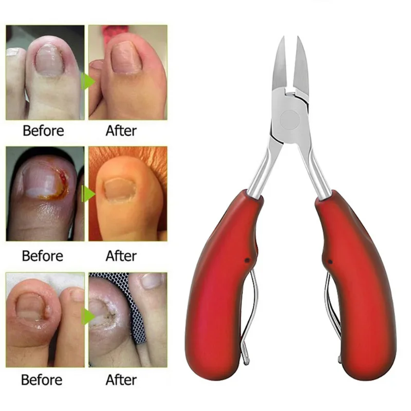 Eagle Beak Toenail Clippers Ingrown Correction Paronychia Improvement Dead Skin Dirt Remover Podiatry Pedicure Trimmer