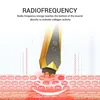Multi-RF Radio Frequency Wrinkle & Anti Ageing Skin Tightening Device Dark Circles For Eye Face Neck Hands Toning Wrinkle Remova 2