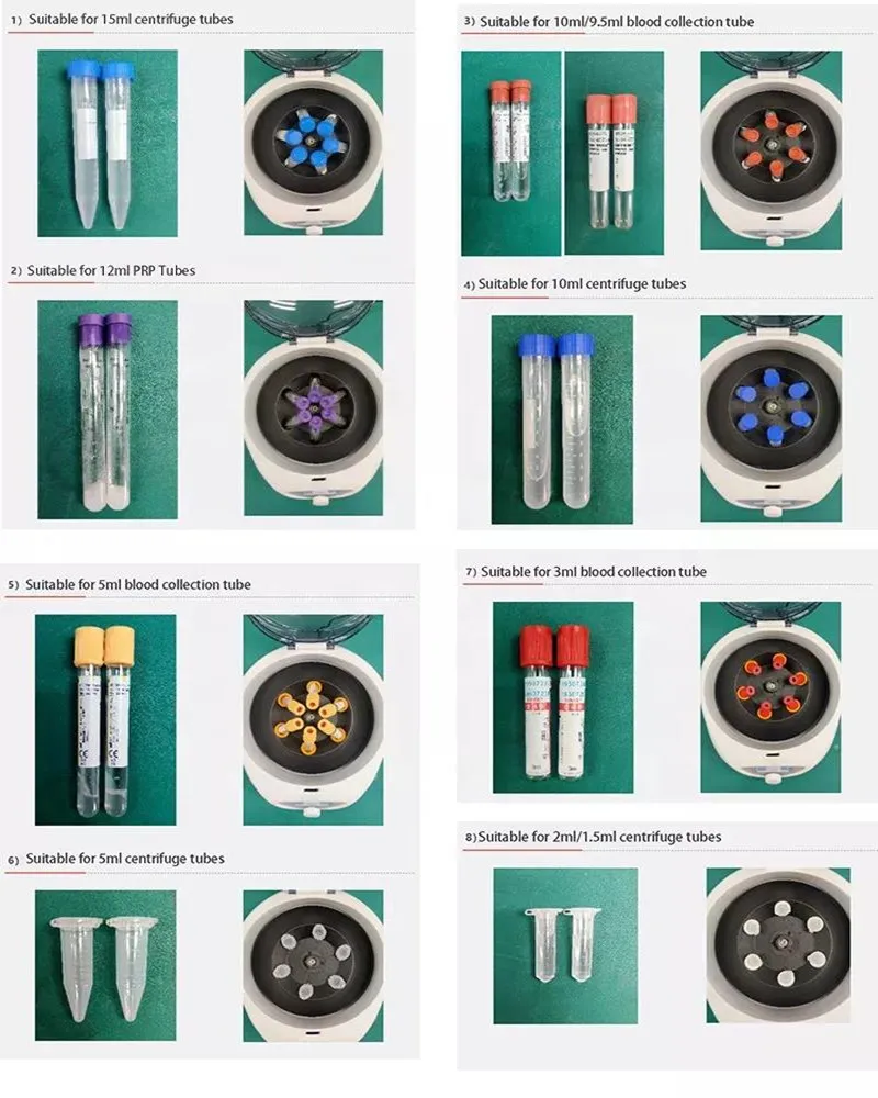 IKEME 저속 원심분리기, 의료 용품, Prp 플라즈마 원심분리기, 혈액 치과 원심분리기, 300-5000rpm