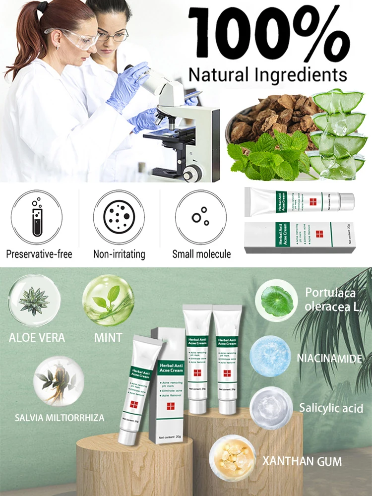 Crema para eliminar el acn&eacute; y las marcas de acn&eacute;, extracto de hierbas, eficaz, antiinflamatoria, reparaci&oacute;n la piel, control