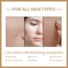 EELHOE Rice Toner for Face Brightening Serum Oil Control Moisturizing Facial Smooth Sensitive Skin Care Pore Shrinking Essence 4