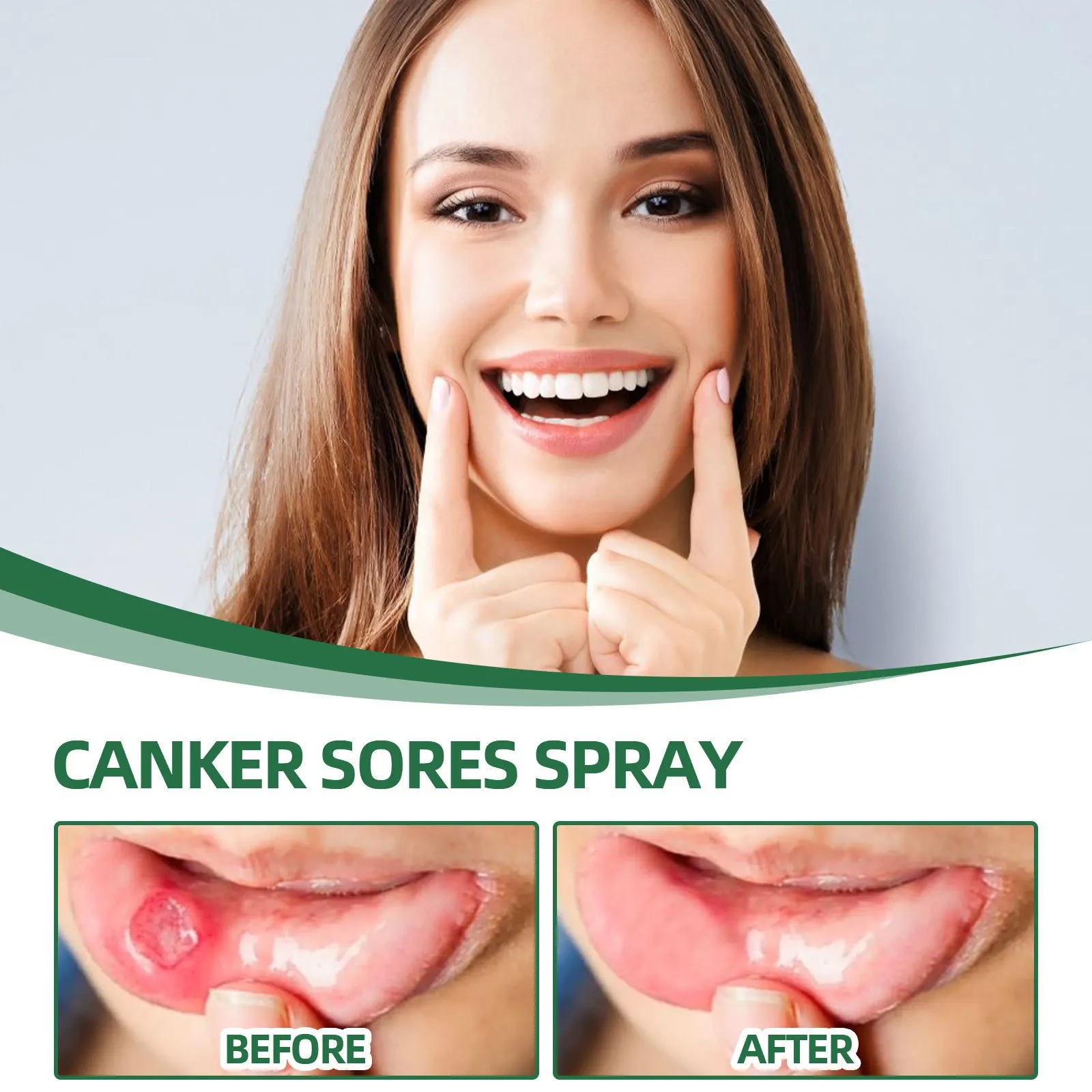 Oral Ulcer Spray 20ml herbal oral spray Canker Sores Swelling in The Gum Fresh Breath and Mouth Ulcer Care Spray Belleza Y Salud Oral Care
