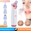 USB Rechargeable Blackhead Remover Vacuum Suction Pore Cleaner Extractor Acne Comedone Whitehead Pimple Removal Spot Cleaner 1