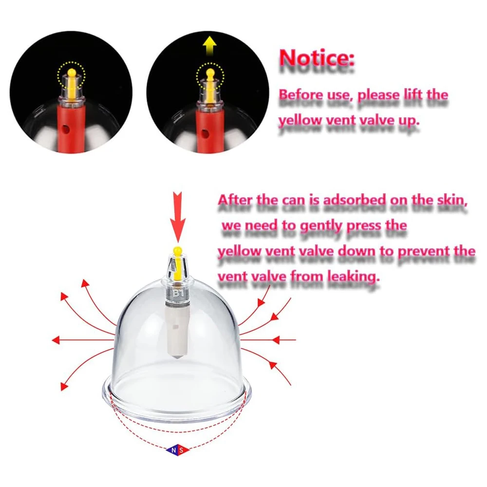32 Cans Back Vacuum Cupping Device Set Professional Suction Cup Massage Meridian Dredge Vacuum Suction Treatment Cupping Device