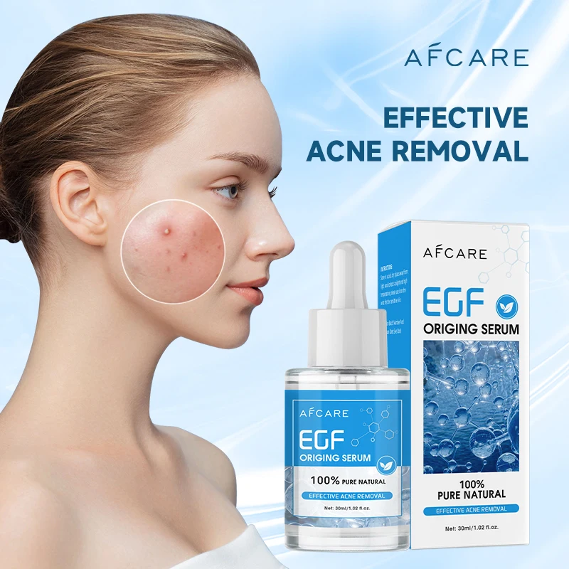 Afcare Acne Treatment Removal Serum 100% EGF Natural Essence Repair Skin Efficiency Clearing Severe Acne Brightening Skin