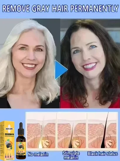 Tueur de cheveux blancs, &eacute;limine les cheveux blancs en 7 jours et restaure la couleur naturelle des