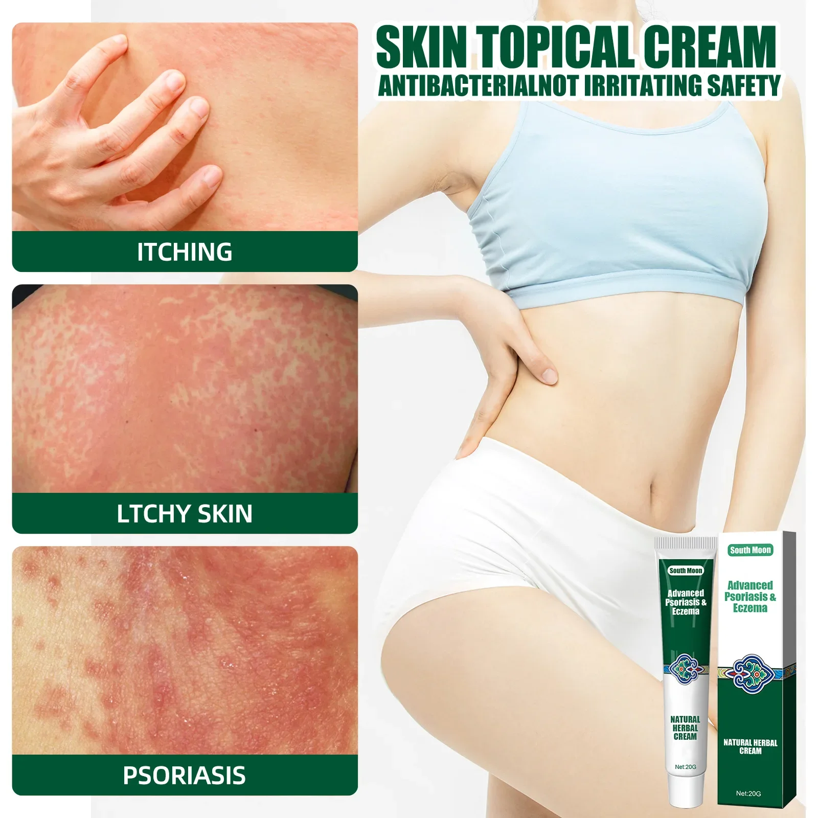 South Moon Psoriasis Ointment Eczema Herbal Cream Treatment Urticaria Desquamation Antibacterial Anti-Itching Health Skin Care