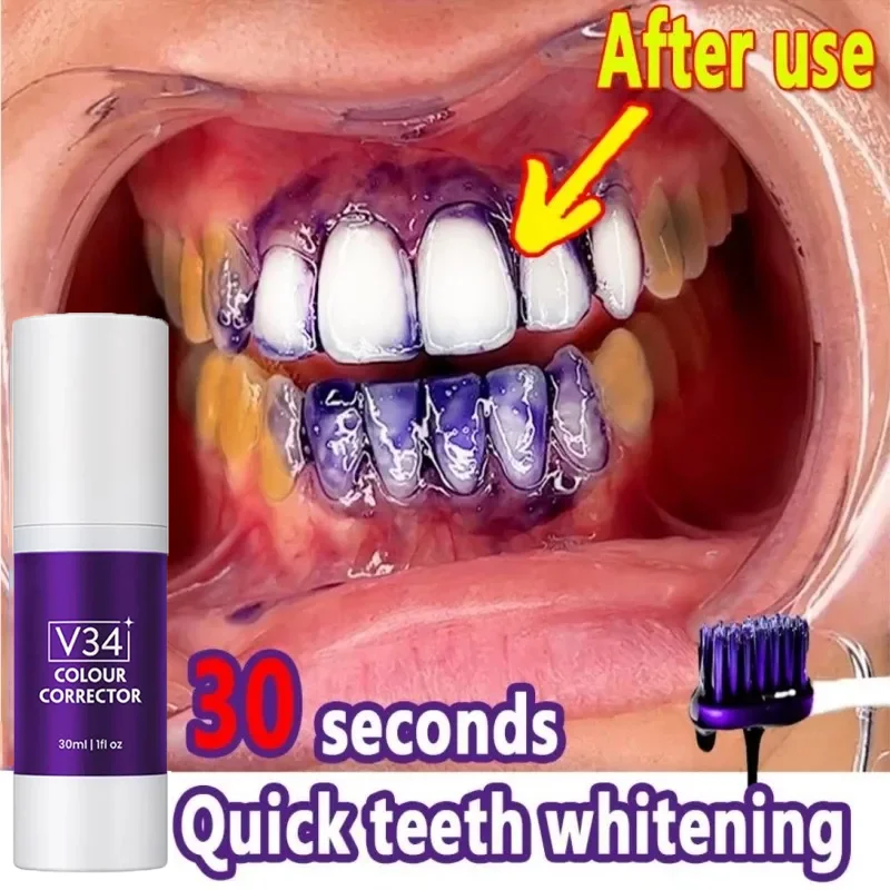 

Purple Whitening Toothpaste Color Corrector Toothpaste For Teeth Remove Stains Reduce Yellowing Care For Teeth Brightening Teeth