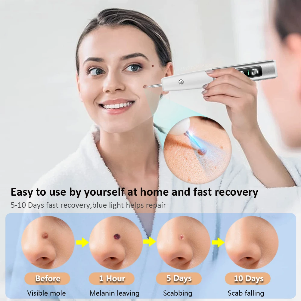 Laser Plasma Pen Electric Skin Tag Remover Tattoo Papilloma Mole Dark Spot Removal Blemish Wart Freckle Eliminator For Face Body