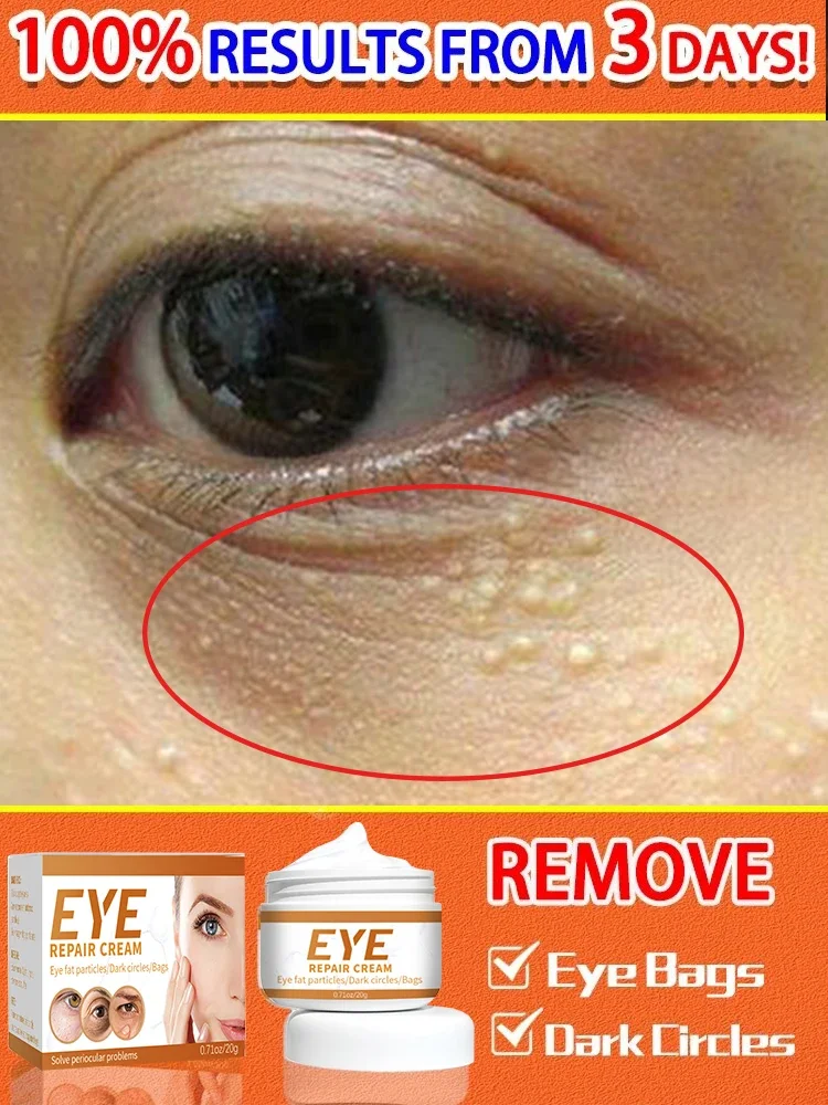 

Dark Circles Eye cream Remove eye bags Puffiness Anti-Wrinkle way work under eyes Lightening Moisturizing Whitening Skin Care
