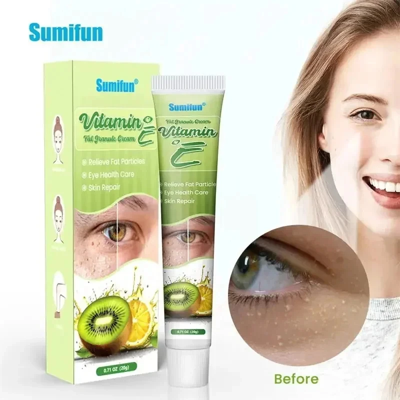 Eye Cream for Fat Granules Puffiness - Milia Remover Skin Repair