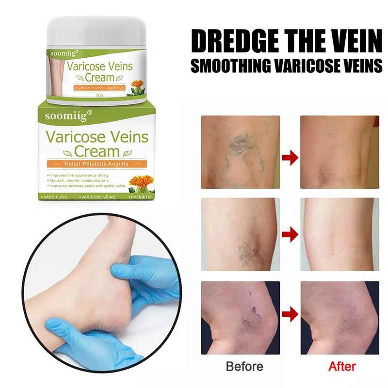 Рисунок 4 - Мазь для восстановления варикозного