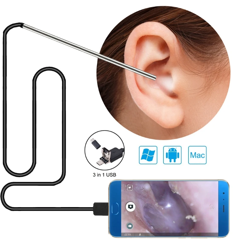 Strumento per la rimozione del cerume 3 in 1, otoscopio USB-telecamera per  orecchio In orecchio pulizia endoscopio cucchiaio per orecchio visivo 5.5mm  otoscopio per orecchio - AliExpress