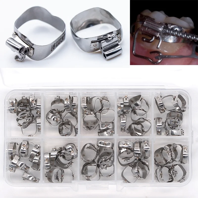 

0.022 1st Molar M Series Kola Bands Pre-Welded With Conv Roth Sgl Tubes 28#-37# 40pcs Orthodontic Molar Bands Dental Material