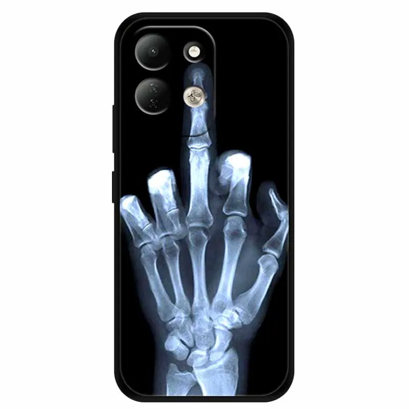 Lion Design Soft Silicone Phone Cover - Black TPU Bumper Case