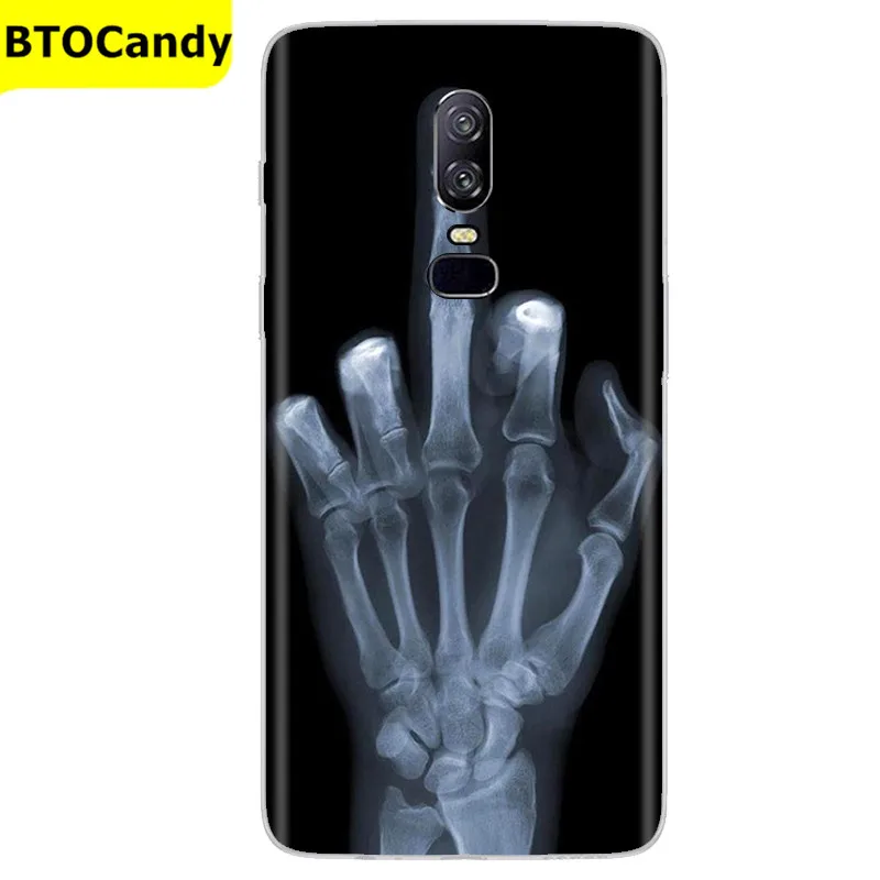 Transparent Silicone Soft TPU Back Cover