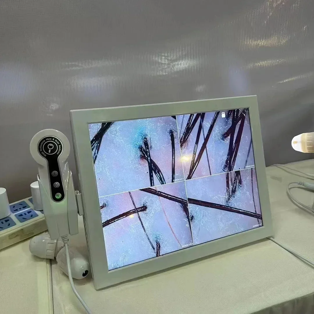 Analizzatore digitale HD della pelle Rilevatore professionale della fotocamera del cuoio capelluto dei capelli Dispositivo per test dell'umidità dell'olio dei follicoli piliferi 15 pollici - immagine 5