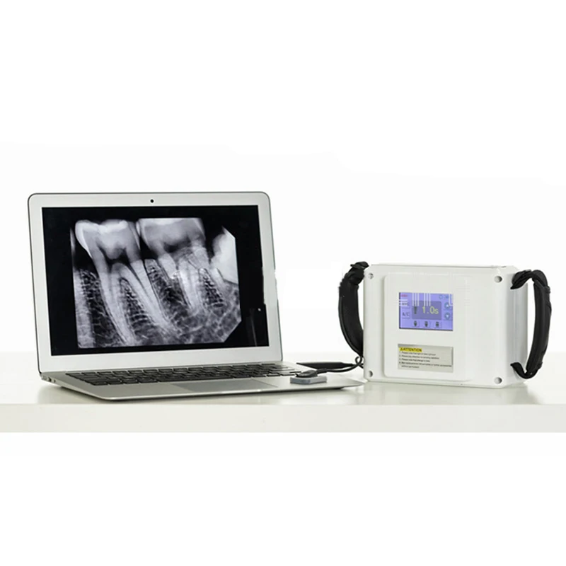 Рисунок 5 - Цифровой стоматологический рентгеновский аппарат