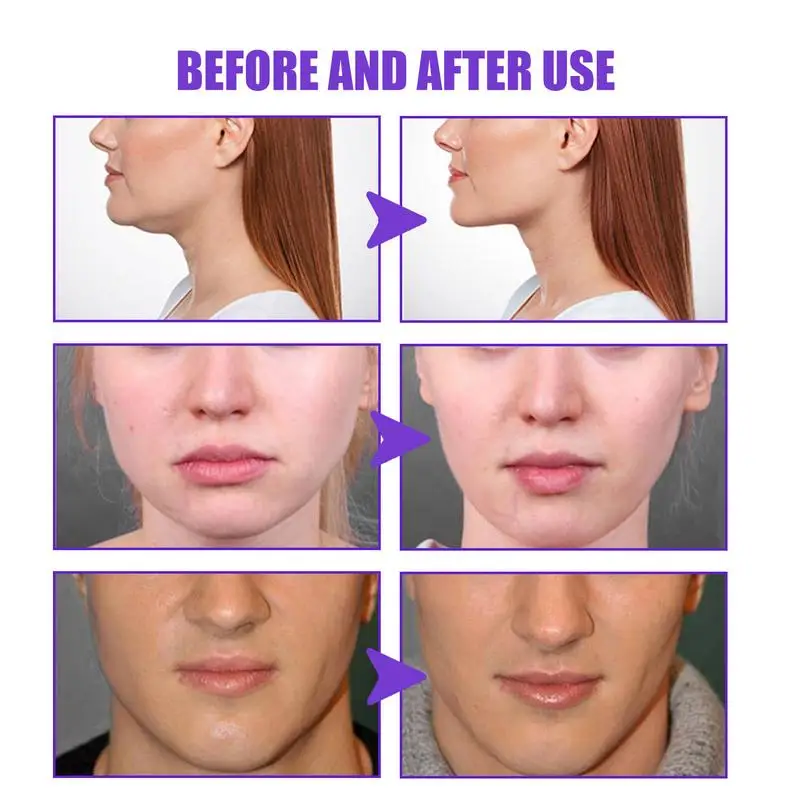 Face Cream Anti Age Lifting Firming Double Chin Reducer Skin Moisturizing for Women