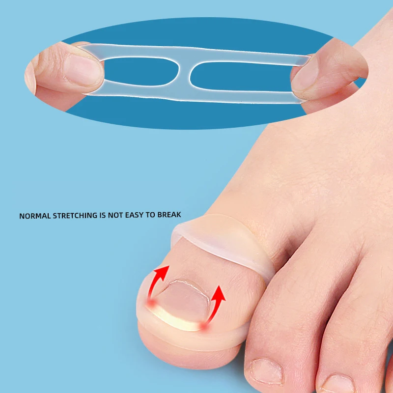 Ingrown Toenail Corrector 2Pcs Silicone Ingrown Toenail Correction Invisible Ingrown Toe Finger Nail Straightening Protector Brace Pedicure Feet Care Tool
