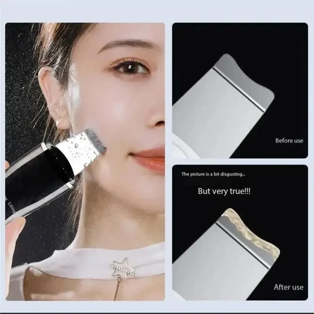 Blackhead Remover Blackhead Cleaning Pore Shrinking Beauty Device Dead Skin Acne Scalper Facial Pore Cleanser 3