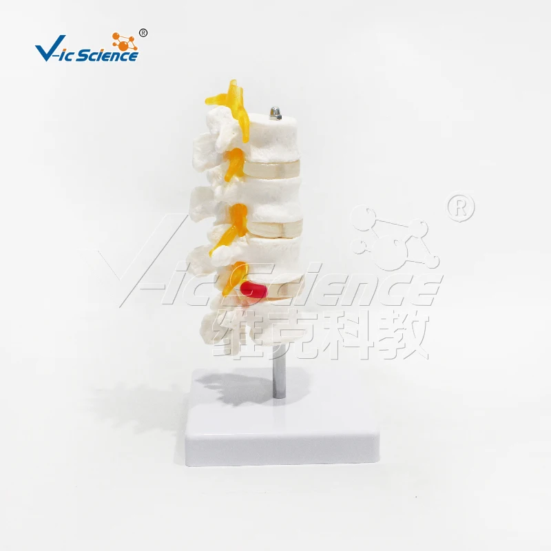 Medical science Four-segment lumbar model