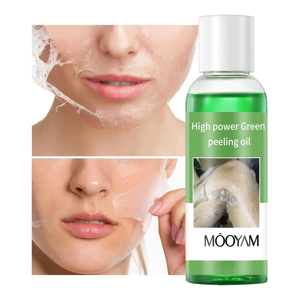 

Exfoliator Green Peeling Oil For Dead Skin Removal Exfoliating facial Strength Peeling Oil Skin Remove Acne 100ml