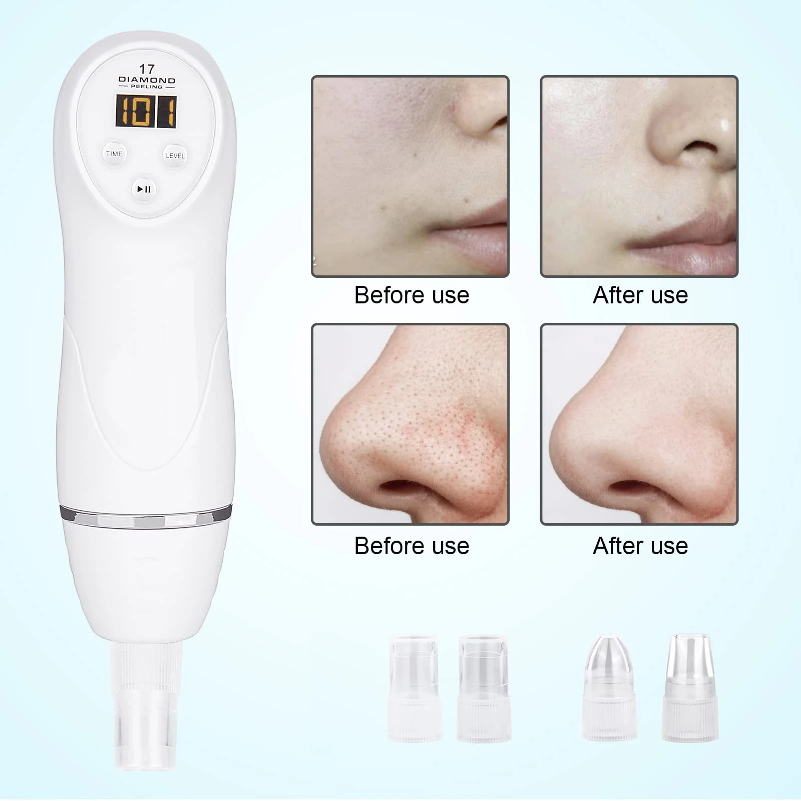 Diamond Microdermabrasion Vacuum Blackhead Acne Cleanser Facial Pore Cleansing Massager Exfoliating Dead Skin Facial Skin Care