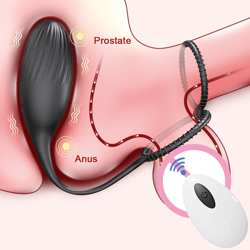 Prostata-Massagegerät mit Cockring, vibrierender Buttplug, Anal-APP-Vibrator, kabellose Fernbedienung, Sexspielzeug für Männer, Arsch, Analdildo für Frauen 1