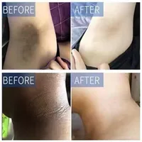 Crème blanchissante pour le corps, parties intimes, aisselles, genoux, cuisses, mélanine intérieure, Lotion éclaircissante, peau foncée, soins pour le corps blancs sains 2