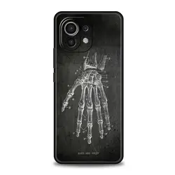 Chalkboard Anatomy Soft Phone Case - Artistic Design Protective Cover for Xiaomi 12T (A5)