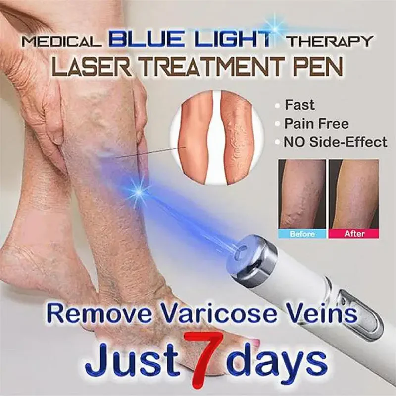 Heath Blue Light Therapy Varicose Veins Treatment Laser Pen Soft Scar Wrinkle Removal Treatment Acne Laser Pen Massage Relax laser skin treatment