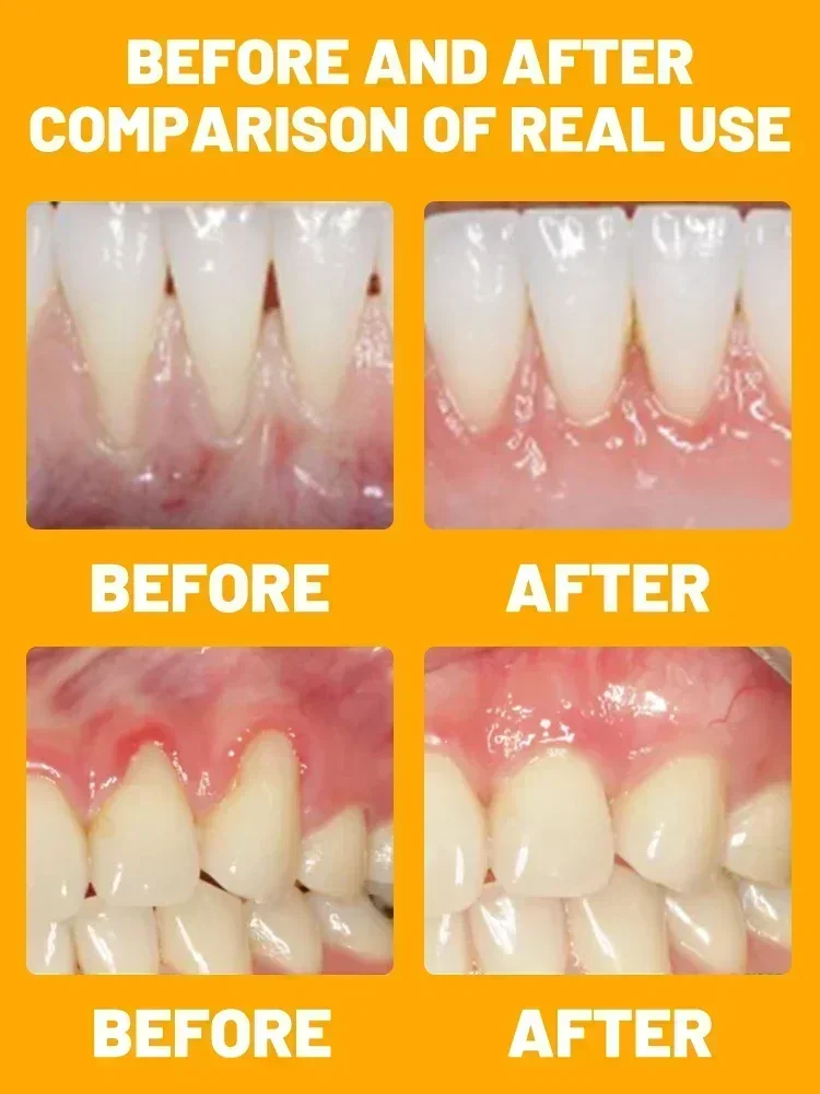 Gum Repair Drops Restore gums