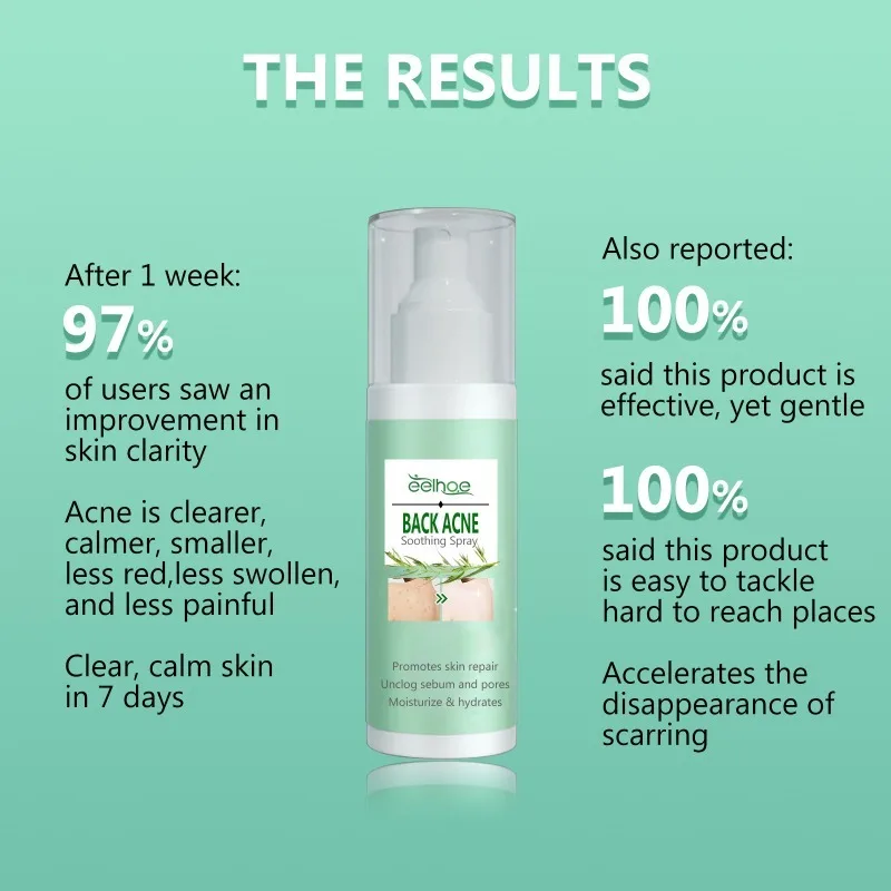 Whitening Cream Back Acne Repair Spray Acne Removal Essence Oil Oil Butt Shoulder Care Cream Control Back Whitening Moisturize Removal Spray