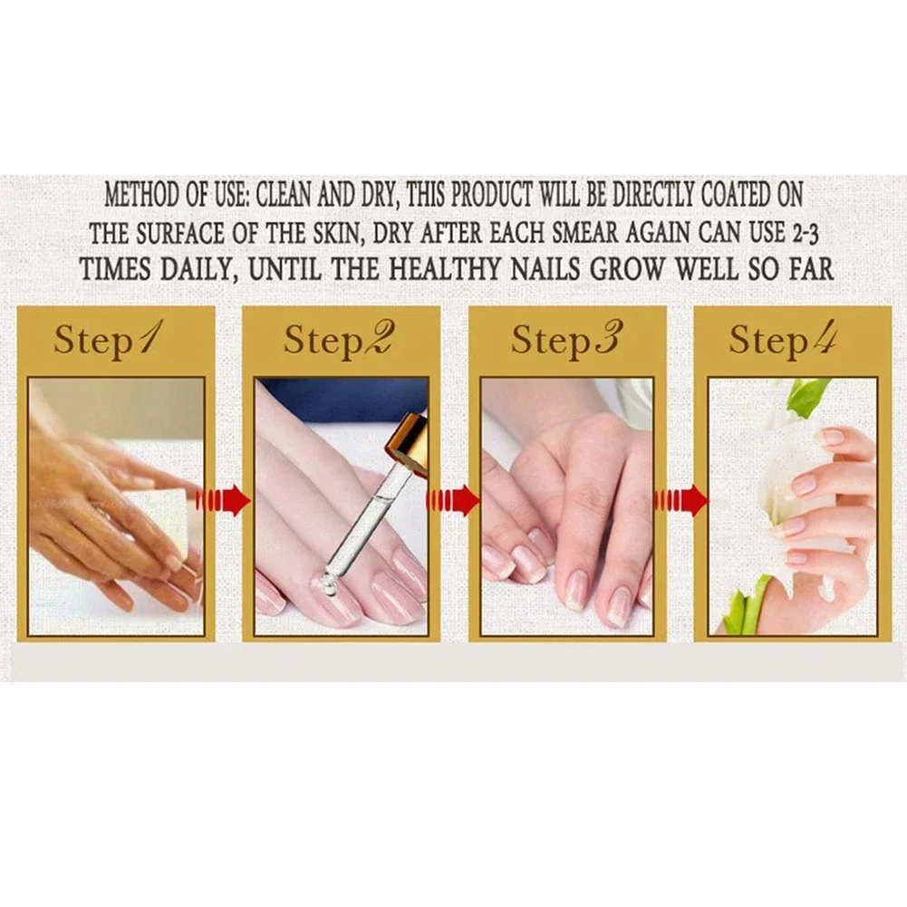Toenail Repair Essence Anti Infection Nail Fungus Treatments Essence Feet Onychomycosis Repair Supply Unisex