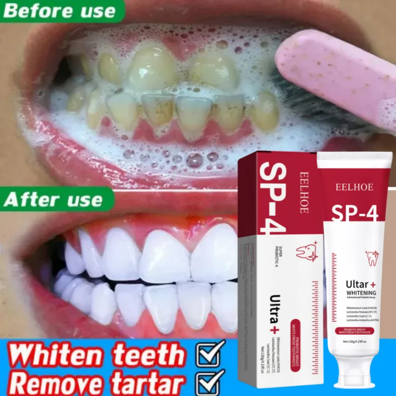 

SP-4 Probiotic Caries Toothpaste Whitening Tooth Decay Repair Paste Removal Yellow Plaque Stain Bad Breath Fresh Oral Clean Care