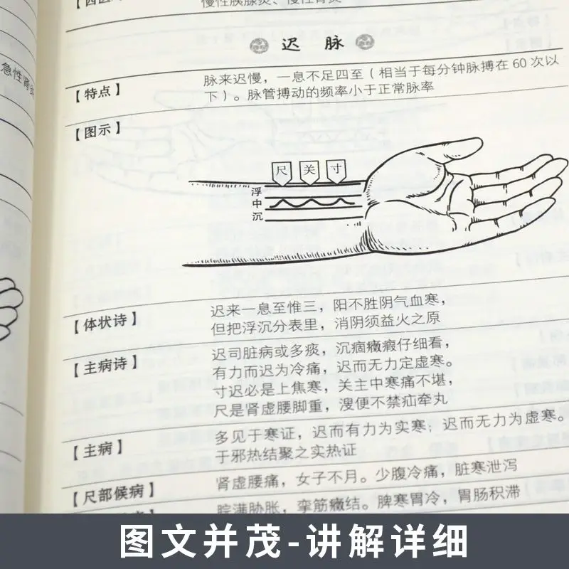 Рисунок 4 - Иллюстрация импульсного атласа Li Shizhen
