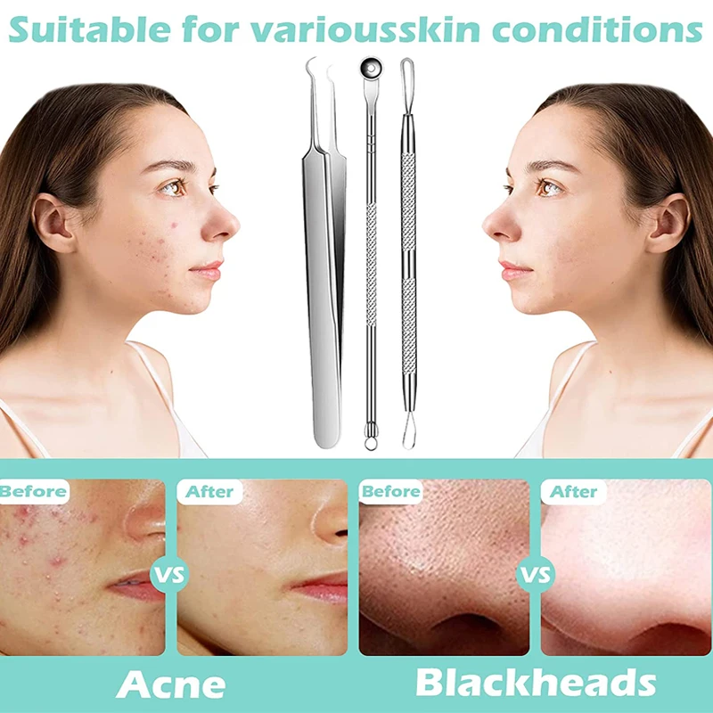 Acne Blackhead Removal Needles Stainless Steel Black Spot Blemish Pimple Removal Needle Deep Cleansing Tool Face Skin Care Kit 2