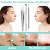 Acne Blackhead Removal Needles Stainless Steel Black Spot Blemish Pimple Removal Needle Deep Cleansing Tool Face Skin Care Kit 2