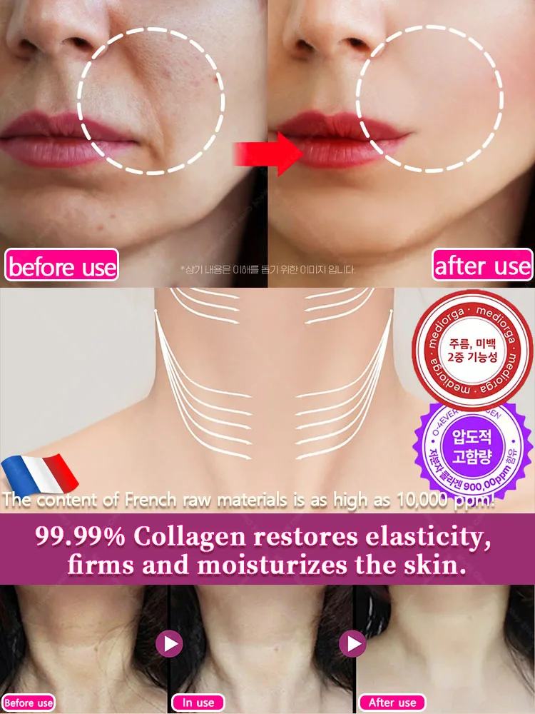 Repair skin, reshape skin factors, remove wrinkles and anti-aging,18 years younger. 2