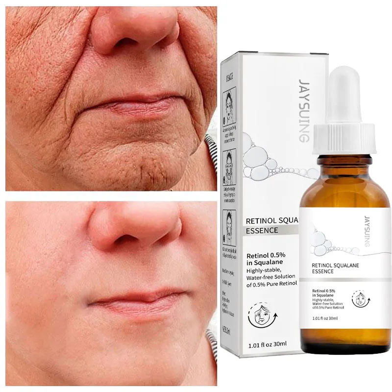 Retinol Anti Aging K r kl k Kald rmak Serum Kald rma Ayd nlatmak Y z retinol-anti-aging-k-r-kl-k-kald-rmak-serum-kald-rma-ayd-nlatmak-y-z