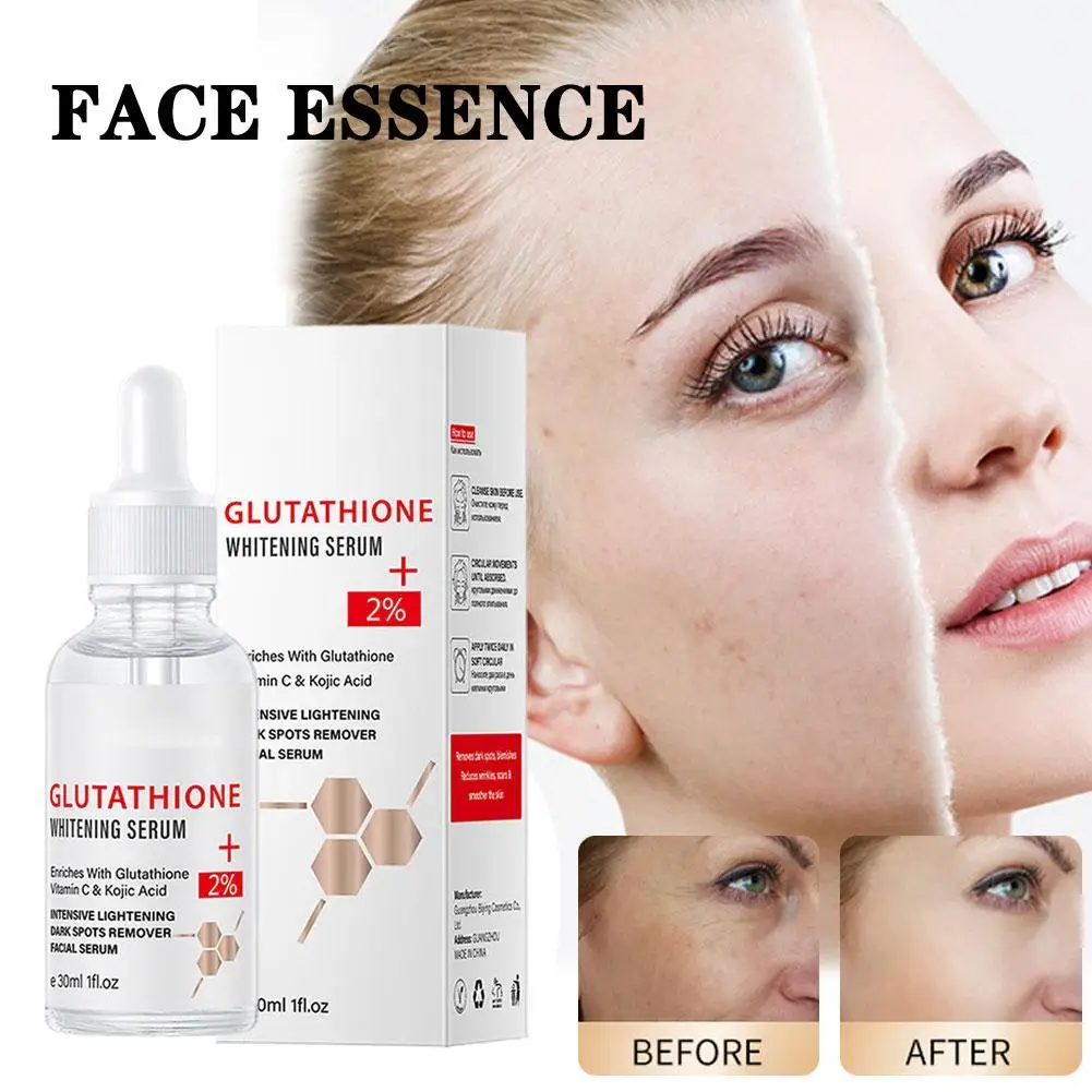 

30ML Glutathione Whitening Freckle Serum Remove Melasma Dark Spots Face Whitening Serum with Vitamin C Nicotinamide Kojic Acid