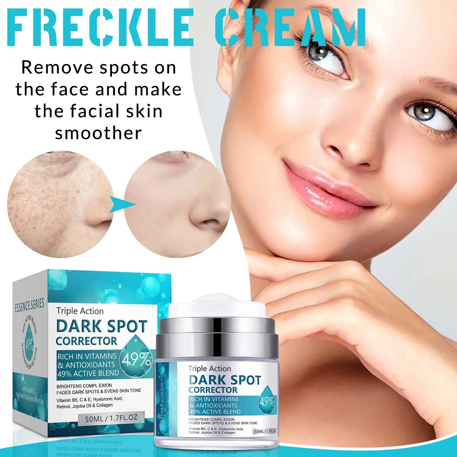thumbnail image 1 of Press Whitening Spots Remover Cream Lightens Spots, Chloasma Freckles Brightens Skin Tone Spots Remover Cream 50ml, 1 of 4
