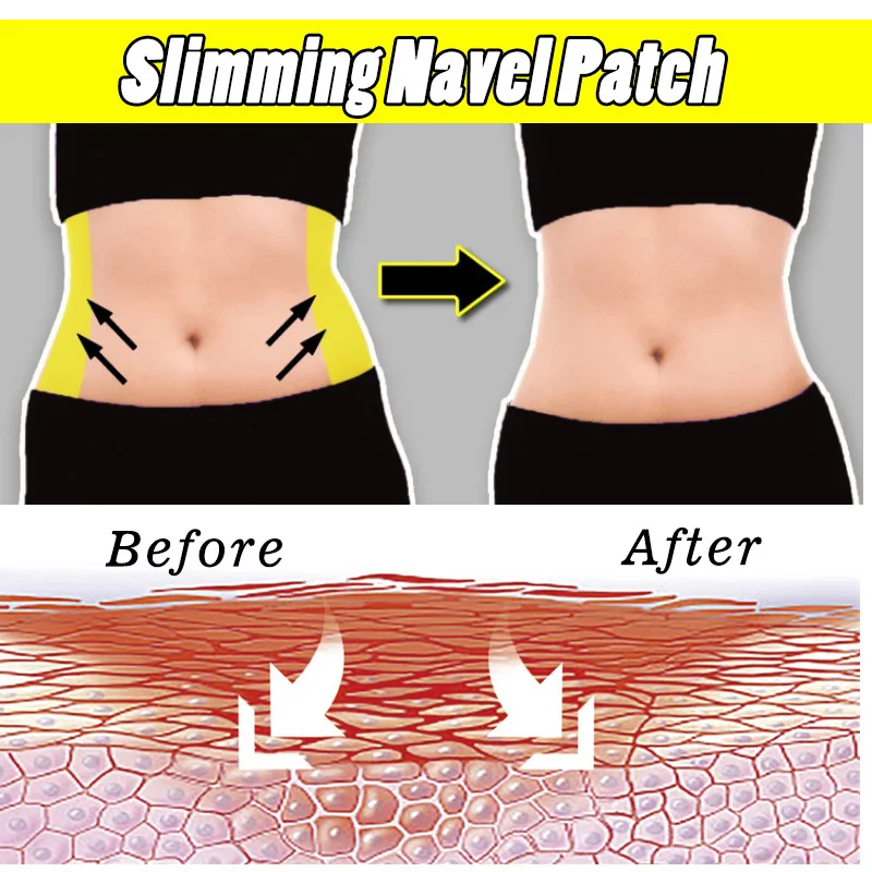 10PCS Slimming Patch Belly Abdomen Lose Weight Fat Burning Navel Stick Weight Loss Slim slimming patches