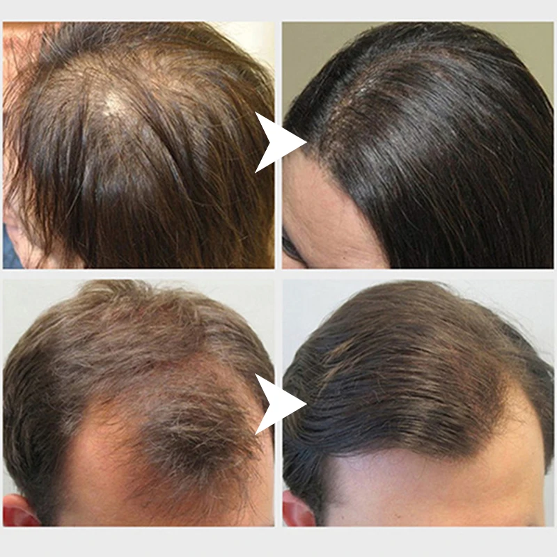 Details more than 78 curcumin hair shedding super hot in.eteachers