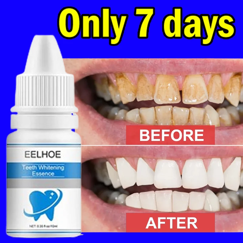 

Tartar Plaque Teeth Deep Cleaning