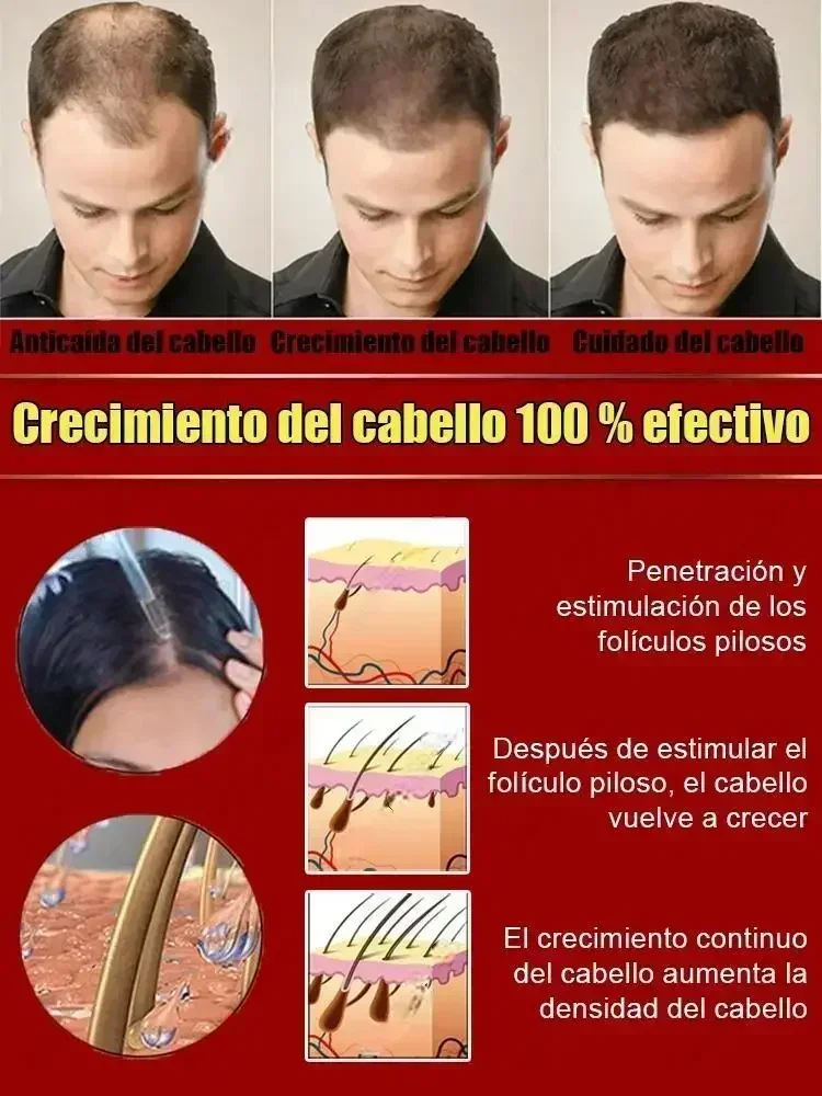 Hair Treatment Hot selling product, 99% of buyers buy again, have more and more hair, say goodbye to baldness, thick hair
